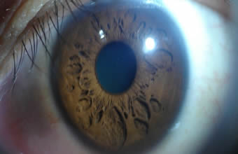 Iridologia e Neturopatia - Foto 1